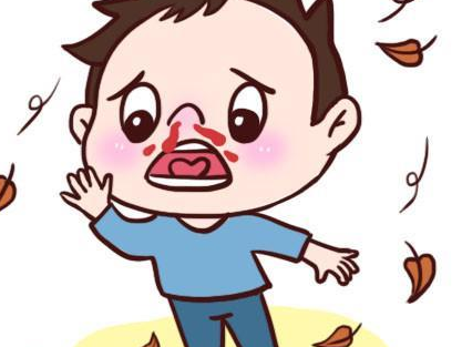 教育新闻：知识科普：流鼻血时最好如何做以达到止血的目的