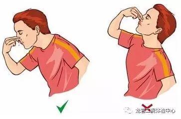 教育新闻：生活知识科普：流鼻血时最好如何做以达到止血的目的