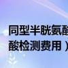 同型半胱氨酸检查在哪个项目里（同型半胱氨酸检测费用）