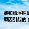 腿和脸浮肿是什么原因引起的（脸浮肿是什么原因引起的）